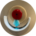 A photo of a normal stoma seal which has been broken down by stoma output.