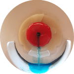 A photo of the Ostoform stoma seal, directing stoma output away from your skin.