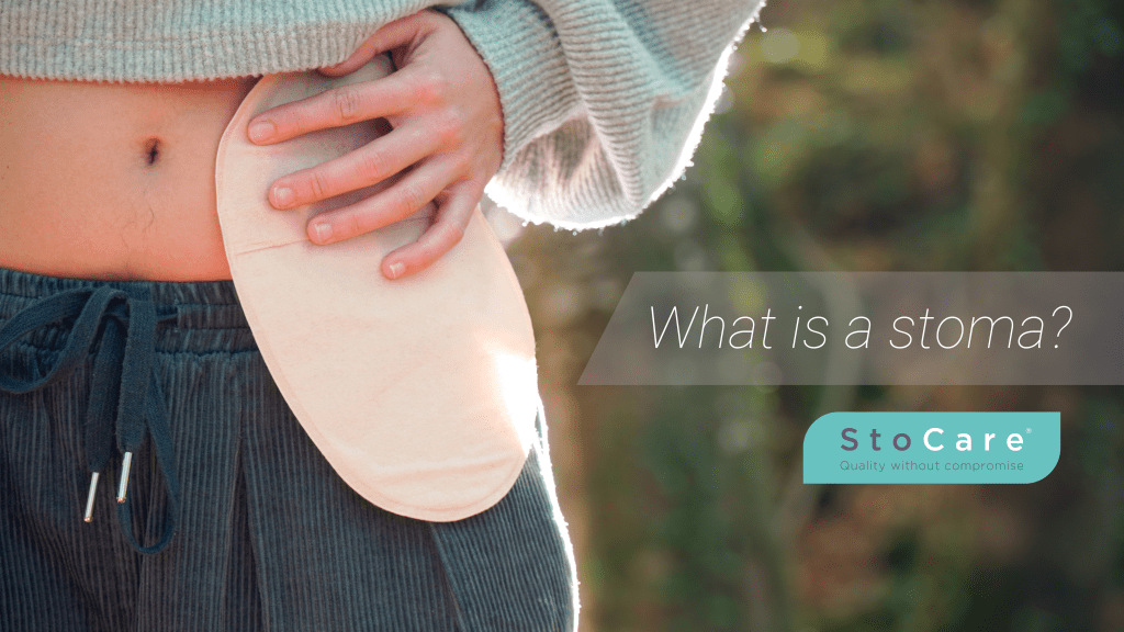 What is a stoma? StoCare blog