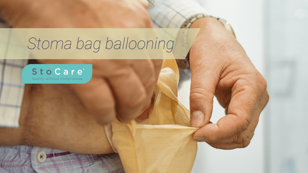 stoma bag ballooning from stocare