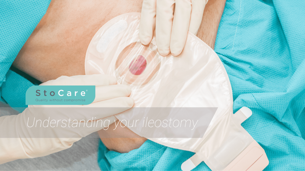 Stoma Device Understanding your ileostomy - StoCare - Rhodes Health