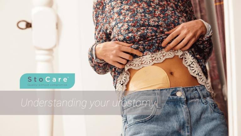Understanding your urostomy