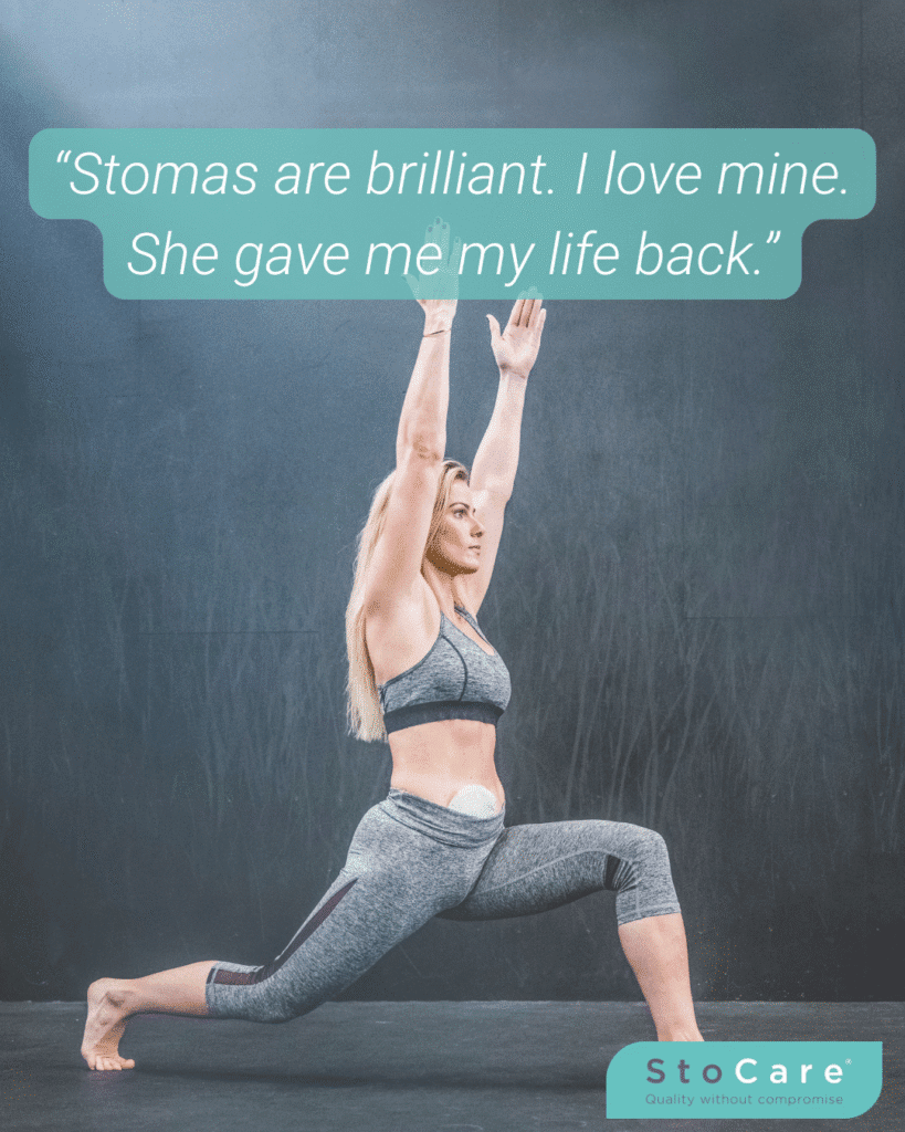 Debunking stoma misconceptions: "stomas are brilliant. I love mine. She gave me my life back."