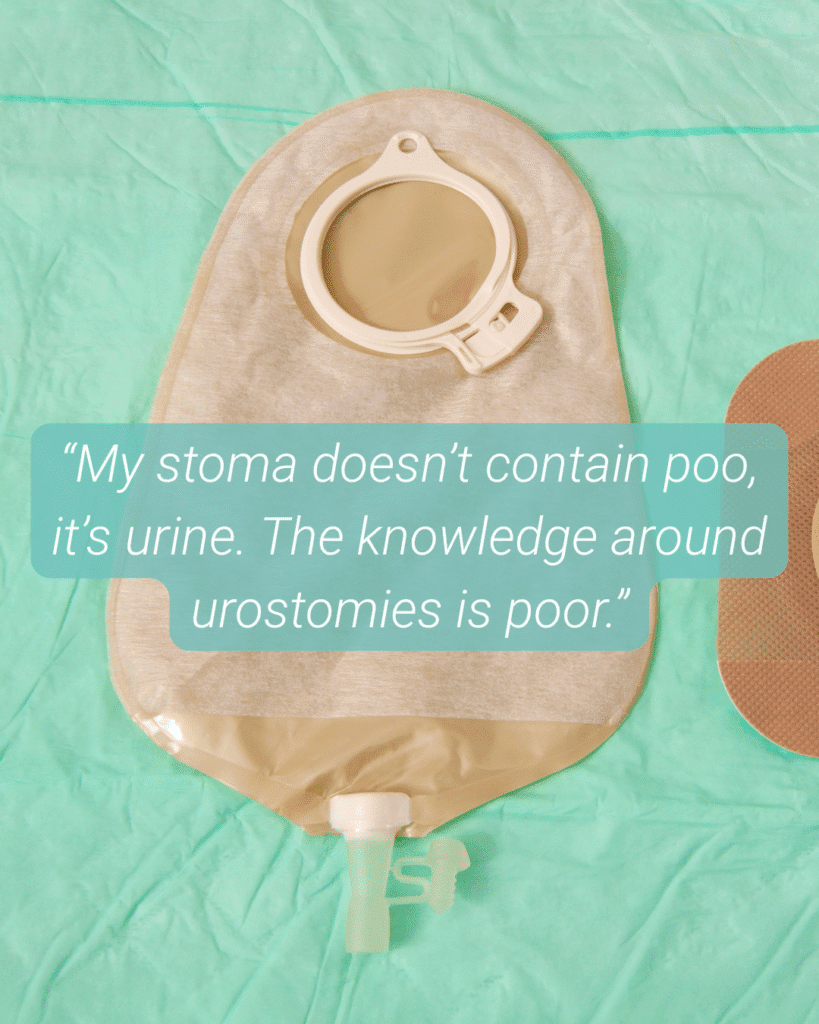 "my stoma doesn't contain poo, it's urine."