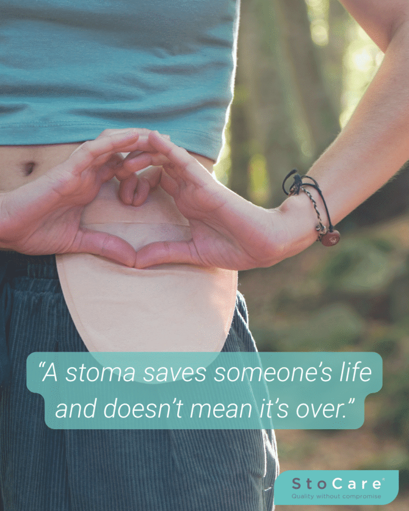 Debunking a stoma misconception: "A stoma saves someone's life and doesn't mean it's over."
