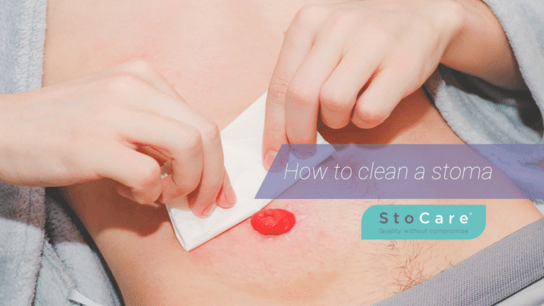 How to clean a stoma
