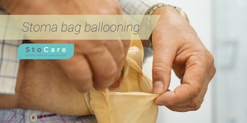 stoma bag ballooning from stocare