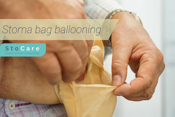 stoma bag ballooning from stocare