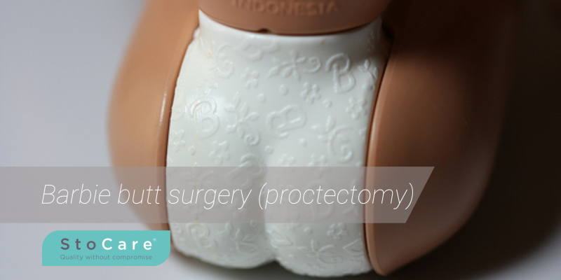 Barbie butt surgery (proctectomy)