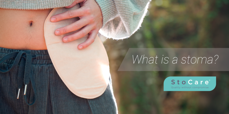 What is a stoma? StoCare blog