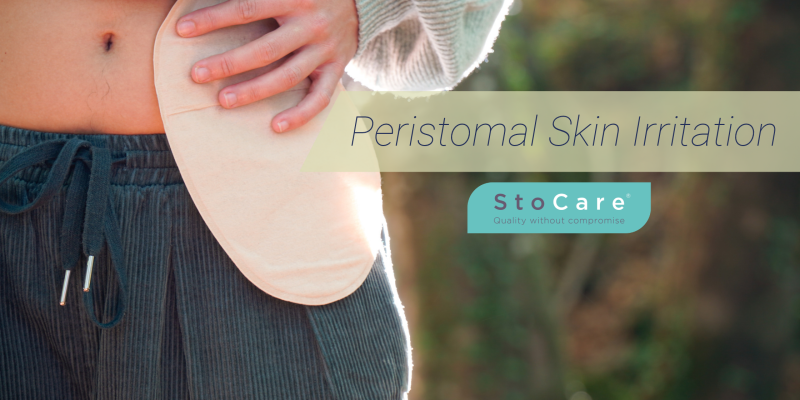 peristomal skin irritation