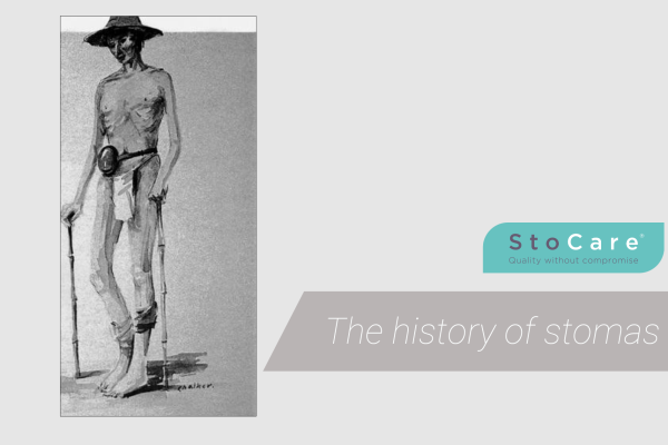 the history of stomas