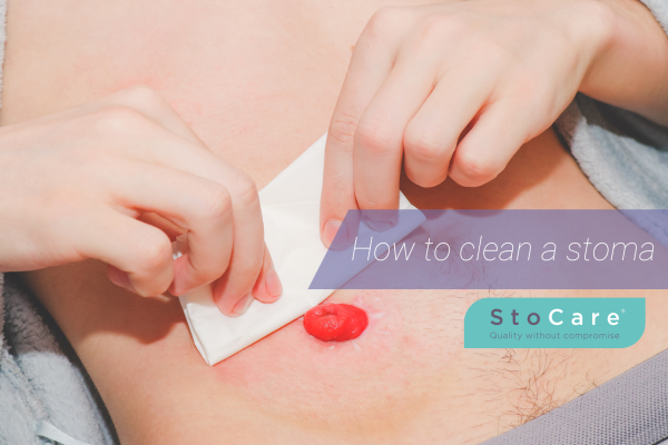 How to clean a stoma