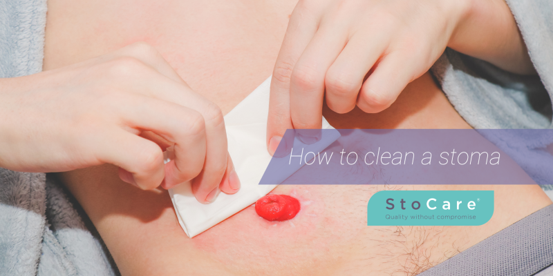 How to clean a stoma