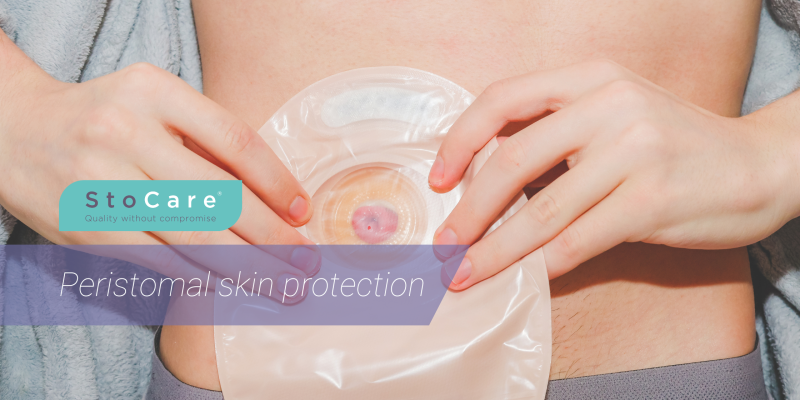 Peristomal skin protection from StoCare.