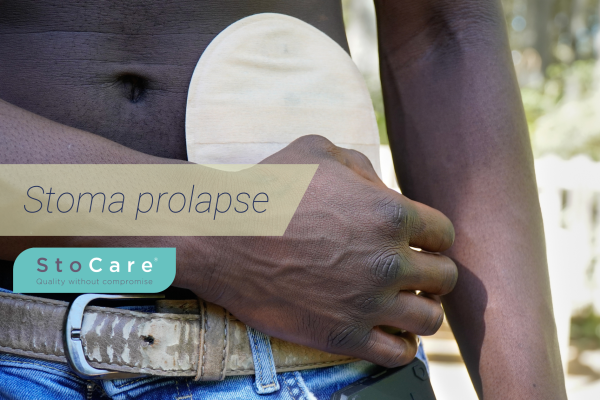 Stoma prolapse
