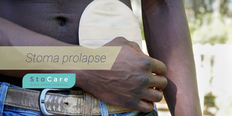 Stoma prolapse
