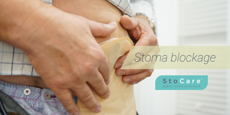 Stoma blockage by StoCare