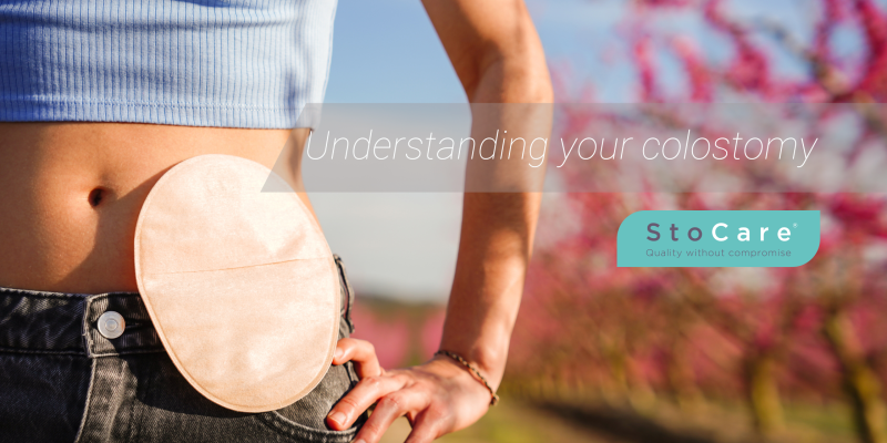 Understanding your colostomy