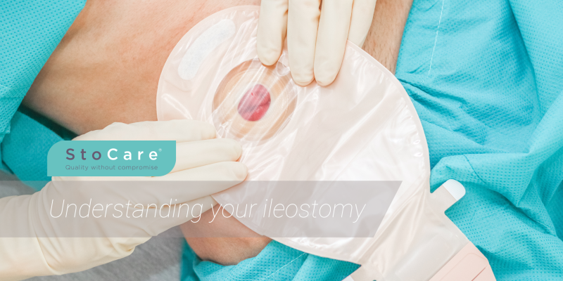 understanding your ileostomy