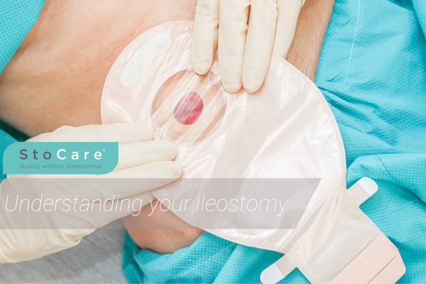 understanding your ileostomy