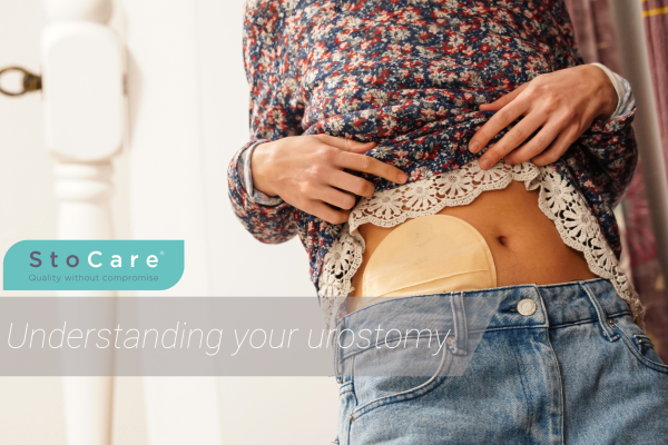Understanding your urostomy