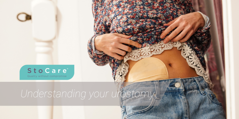 Understanding your urostomy