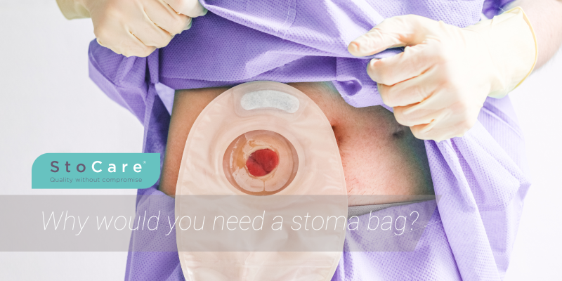 Why would you need a stoma bag from StoCare