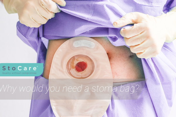 Why would you need a stoma bag from StoCare